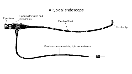 endoscope